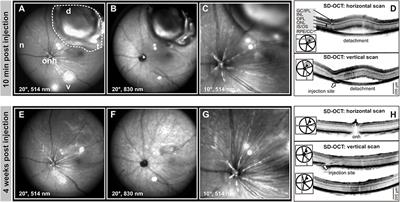 AAV-Mediated Gene Supplementation Therapy in Achromatopsia Type 2: Preclinical Data on Therapeutic Time Window and Long-Term Effects